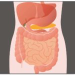 Small Intestinal Bacterial Overgrowth in Modern Bariatric Surgery
