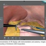 Simulation in Laparoscopic Bariatric Surgery