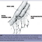 How to Perform an Antiobstruction Stitch